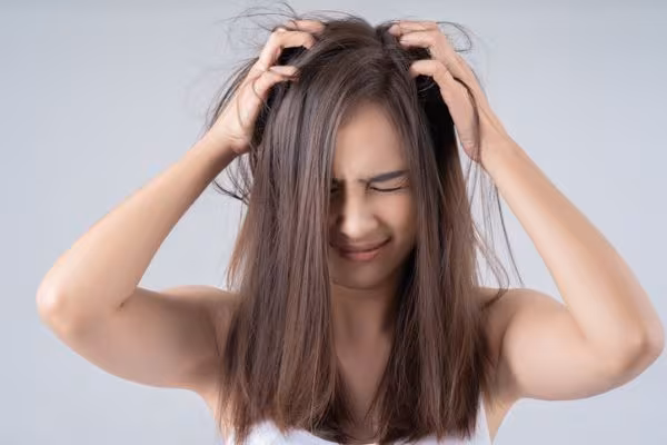 Winter Dandruff 2025: Proven Ways to Get Rid of Dry Scalp Naturally