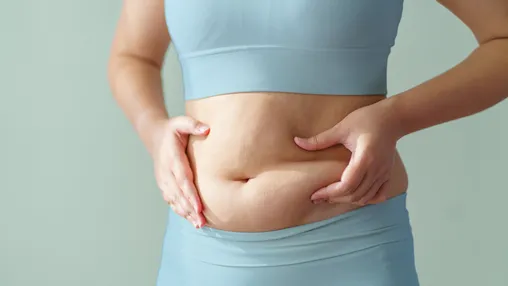 Hormonal Belly: Causes & 9 Natural Ways to Shrink It Fast